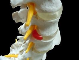 脊椎全体像 椎骨動脈・脊髄付きモデル