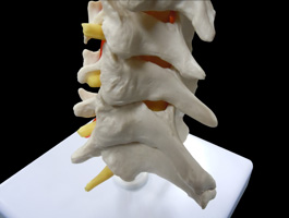 頸椎・椎骨動脈・脊髄モデル