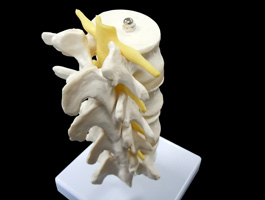 腰椎・脊髄模型