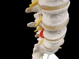 腰椎・仙骨・脊髄神経モデル