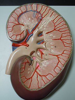 腎臓拡大 デラックス模型