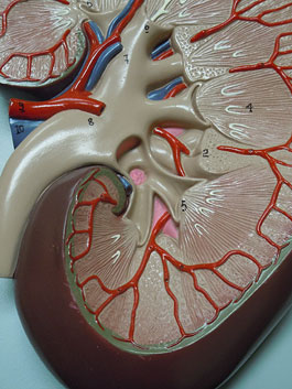 腎臓拡大 デラックス模型