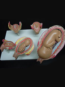 子宮・胎児発育スタンダード模型