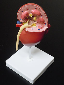 腎臓病変模型