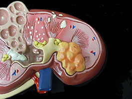 腎臓病変模型