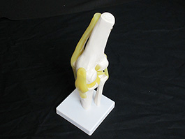1靭帯付き膝関節模型